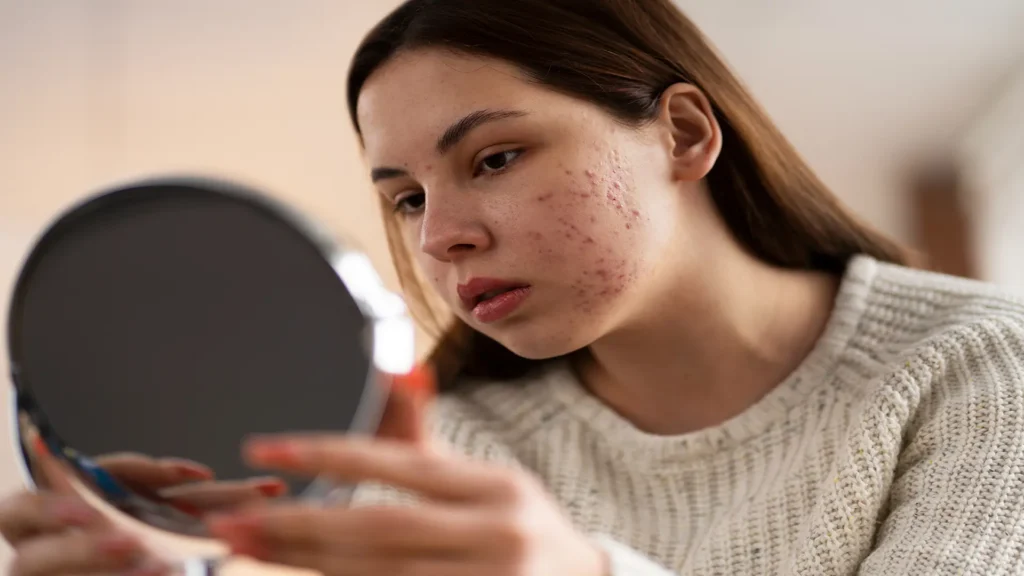 person dealing with rosacea